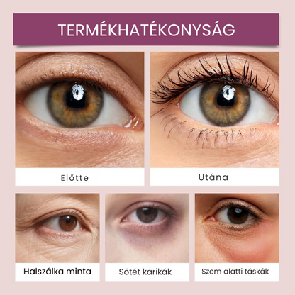 Ranoza Lift Balzsam - Fiatalos megjelenés természetes módon, rövid időn belül.