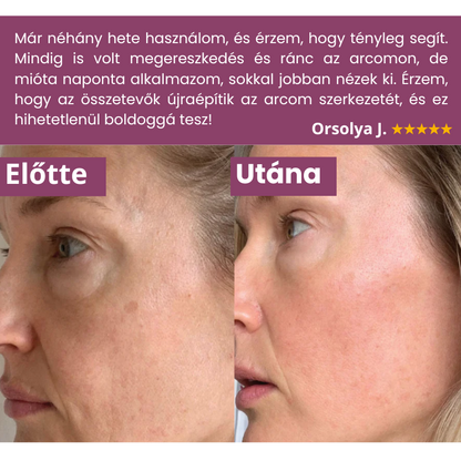 Ranoza Lift Balzsam - Fiatalos megjelenés természetes módon, rövid időn belül.