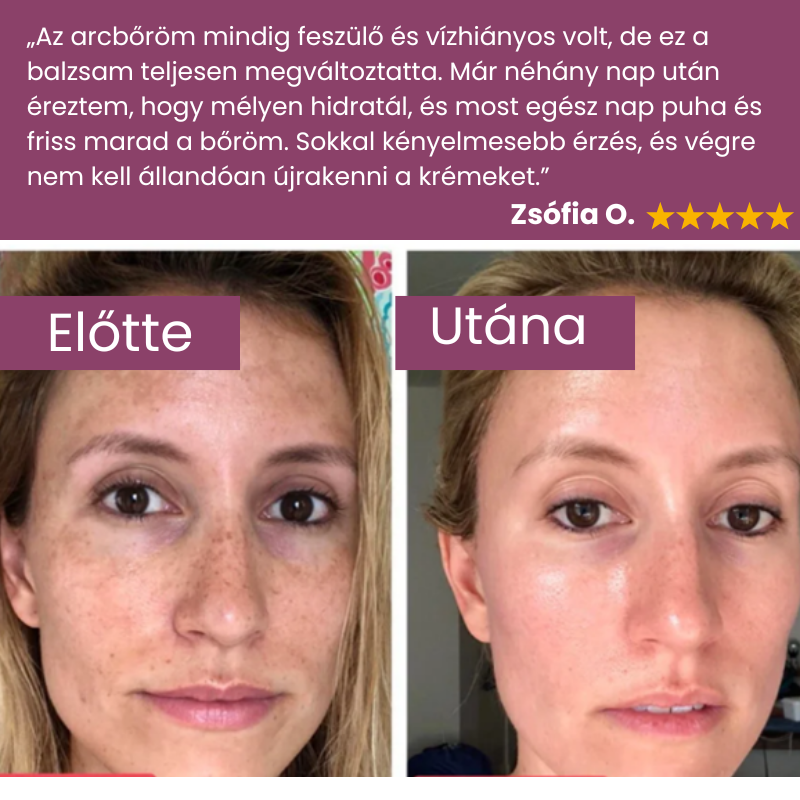 Ranoza Lift Balzsam - Fiatalos megjelenés természetes módon, rövid időn belül.